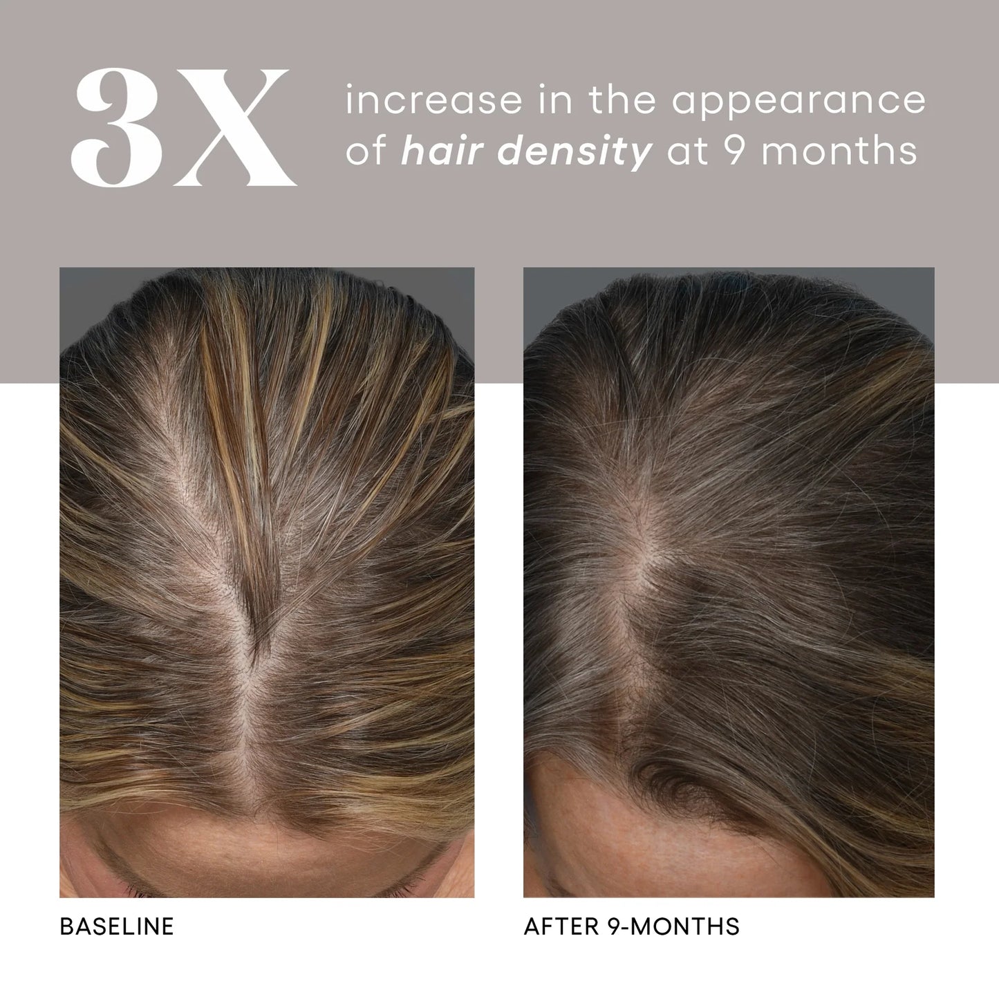 Plated Skinscience HAIR Serum