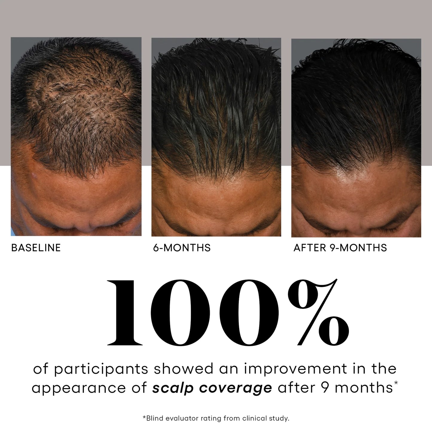 Plated Skinscience HAIR Serum